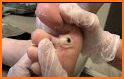 Ladybug Foot Care - The Foot Doctor related image