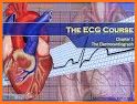 InVivo: ECG Course related image