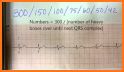 ECG Rhythm and Pulse related image