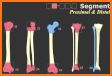 AO/OTA Fracture Classification related image