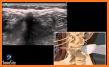 SonoAccess: Ultrasound Education App related image