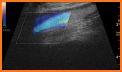 Vascular Ultrasound related image