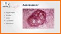 ABC Dermatology for Nurses and Medical Students related image