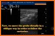 MSK ultrasound Lower Limb related image