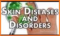 Diseases & Disorders related image