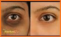 tips sehat dan mudah cara tepat merawat mata anak related image