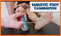PEDIS Score Diabetes App - Diabetic Foot Ulcer related image