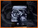 Momitalk: Pregnancy Ultrasound related image