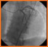 CardioExpert I related image