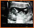 Latest Ultrasound End-End related image
