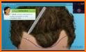 Hair Transplant Simulation related image