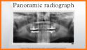 Dental Panoramic Radiology related image