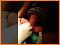 Real Circumcision Surgery Simulator related image
