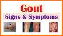 A gout related image