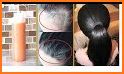 Natural Baldness Treatments related image