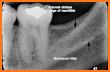 Dental Panoramic Radiology related image