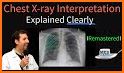 X-ray Interpretation for Medical Use related image