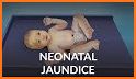 BiliMate • Neonatal Jaundice related image