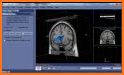 Medical Atlas - Medical Imaging & Radiology Tool related image