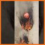 Ball fire related image