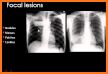 A-Z Chest X-Ray Interpretation related image