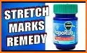 Get Rid Of Stretch Marks Naturally related image