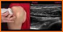 MSK ultrasound Upper Limb related image