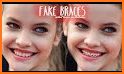 Braces Photo Camera Filters related image