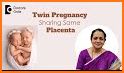 Pregnant Twins Newborn Care related image