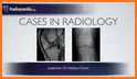 Musculoskeletal X- Rays Interpretation related image