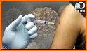 HPV Vaccine: Same Way, Same Day related image