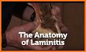 Laminitis related image