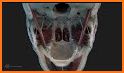 Skull, Teeth & TMJ related image