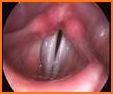 Vocal Folds ID related image