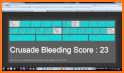 CRUSADE Bleeding Score related image