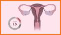 Menstrual Calendar related image