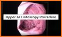 Endoscopic Classifications related image