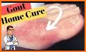 Gout Relief Recipes related image