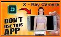 Xray Body Scanner Real Camera related image