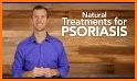 Psoriasis natural treatment related image