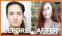 BeautySocial: Plastic Surgery  related image