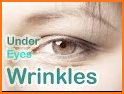 Under Eye Wrinkles Home Remedies related image