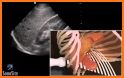 Fast Scan related image