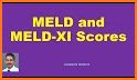 MELD Score Calculator - Liver Disease App related image