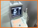 Abdominal Ultrasound pc related image