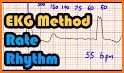 ECG Rhythm and Pulse related image