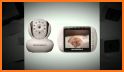 Babywatcher - Smart Baby Sleep Monitor related image