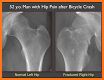 Radiology Xray Medical Imaging related image