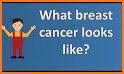 Breast Cancer Healthline related image