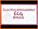 ECG  Interpretation and Tests. related image